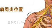 哪些偏方可以治疗肩周炎