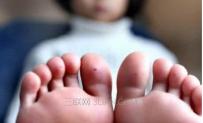 鸡眼是怎样形成的