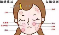 引起皮肤过敏的原因有哪些