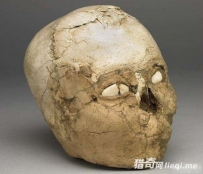 9500年前畸形头骨 其下葬方式惊呆考古专家