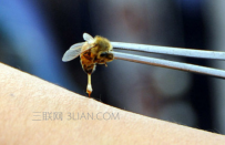 被蜜蜂蛰了怎么消肿止痒
