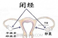 女性闭经是怎么回事