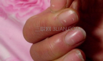 缺锌的症状