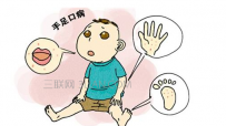 手足口病怎么传播如何预防