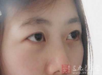 色盲能治吗 这样治疗色盲病比较好