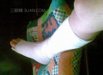 骨折后注意事项有哪些