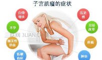 子宫肌瘤症状有哪些