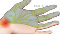 如何预防手指发麻