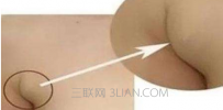 为什么会长副乳