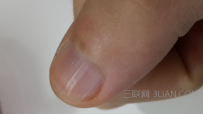 指甲有竖纹是什么原因