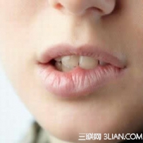 冬季嘴唇干裂脱皮怎么办?