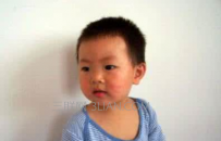 天花是什么病