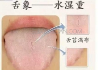 从舌头能看出什么