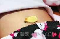生姜贴肚脐眼有何作用