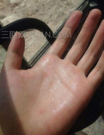 手心出汗是什么原因