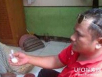 能下蛋的男人：印尼一男子竟每三月产蛋一次