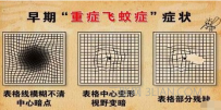 飞蚊症是怎么引起的