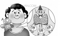 甲亢能治愈吗