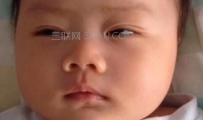 为什么会睁眼睡觉