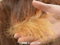频繁染发最伤头发毛囊致脱发