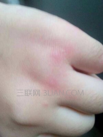 身上很痒是怎么回事