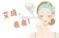 祛痘小窍门