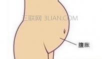 肚子胀气怎么办快速解决