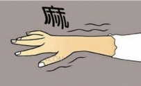 手脚发麻是怎么回事