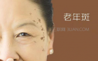 怎样消除老年斑