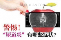 尿道炎有哪些症状