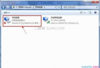 本地连接怎么不见了怎么办