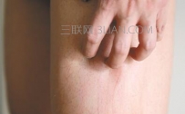 身上轻微痒怎么办