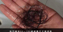 每天掉发多少根算正常
