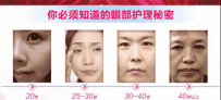 眼下皱纹怎么去除 去眼下皱纹用什么眼霜