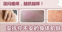 湿疹是怎么引起的