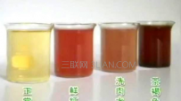 女性小便很黄是怎么回事