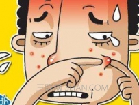 如何防止青春痘
