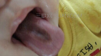 舌苔发黑是怎么回事