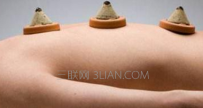 艾灸可以治疗近视眼吗