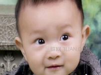 如何预防红眼病