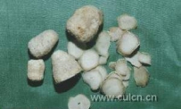 化痰止咳平喘药白附子