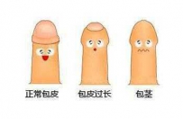 割包包皮皮后的手术线多久 割包皮可以提高性能力吗