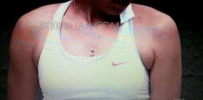 怎么判断自己是否有副乳