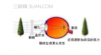 近视眼怎么恢复