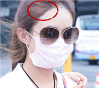 完美发际线破功赵丽颖的额前也秃了