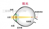 200度散光有什么症状