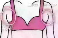 副乳是什么