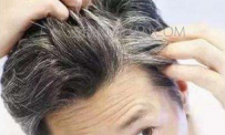 如何白发变黑发