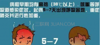 流行性感冒和普通感冒的区别