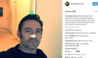 金刚狼 拍摄前期休·杰克曼皮肤癌复发 身上多处动刀